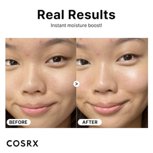 Korean skincare in Pakistan – COSRX Hyaluronic Acid 3% Serum