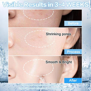 COSRX The Niacinamide 15 Serum for acne and dark spots – Pakistan