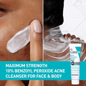 CeraVe Acne Foaming Cream Wash for daily acne control – now in Pakistan