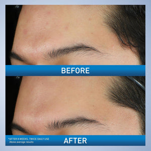 CeraVe Acne Foaming Cream Wash for smoother, acne-free skin – available in Pakistan