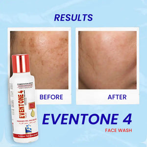 Eventone-4 Lightening Face Wash