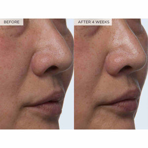 Glow Recipe toner results