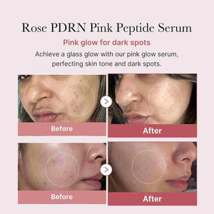 Medicube Rose Pdrn Pink Peptide Serum