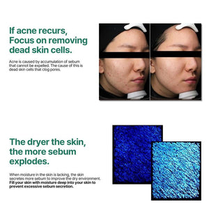 Buy Some By Mi Miracle Acne-fighting toner