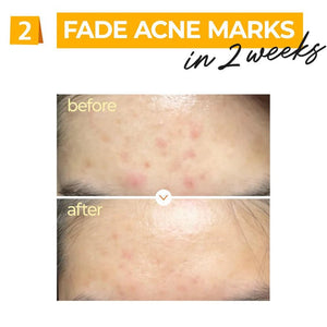 Numbuzin No.5 Vitamin Serum