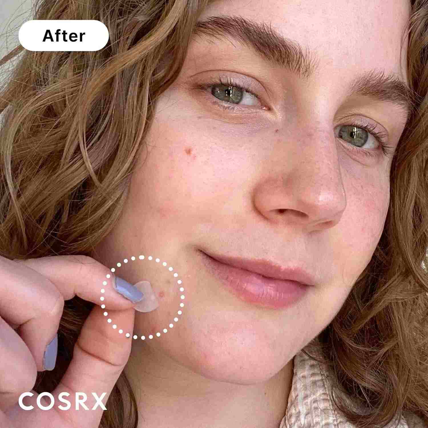 Cosrx_Acne_Patch
