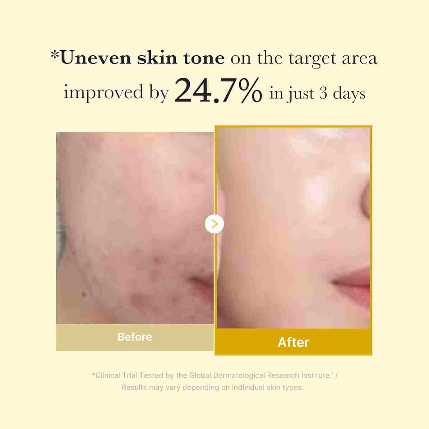 Medicube Kojic Acid Turmeric Night mask Results