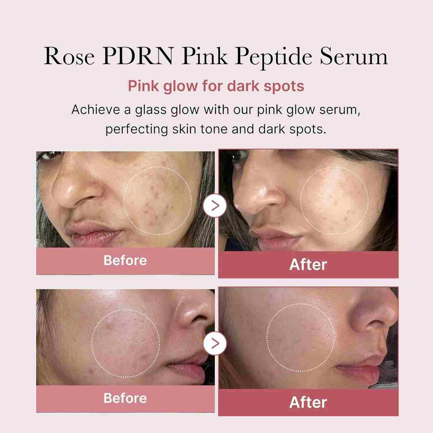 Medicube Rose Pdrn Pink Peptide Serum 